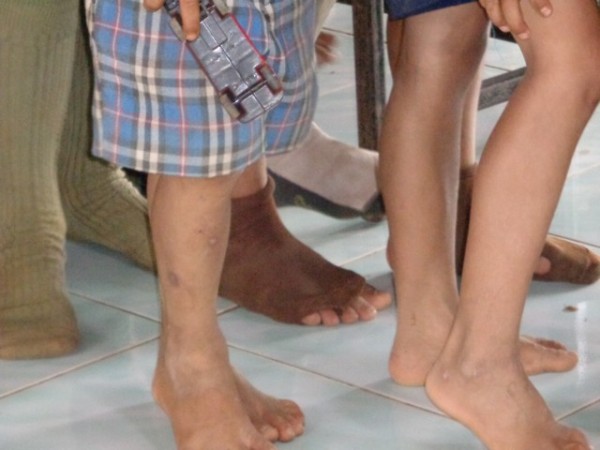 The sock problem was not as prevalent today, but a lot were simply not wearing socks.
