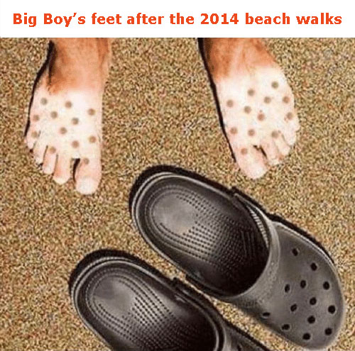 BB's crocs.jpg