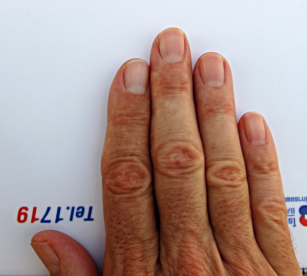 rightRingFinger.JPG