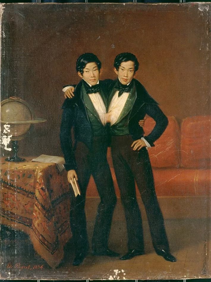 Chang Eng, captured in this 1836 portrait. (Supplied: Wellcome Collection)